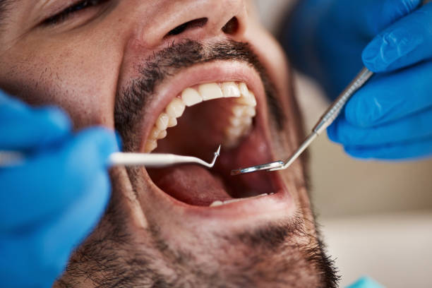 Best Broken or Chipped Tooth Repair in Bogota, NJ